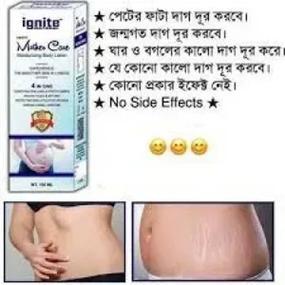 ignite mother care lotion